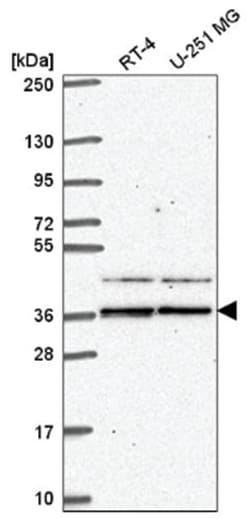 SPRY1 Antibody, Novus Biologicals 100&mu;L; Unlabeled:Antibodies, Polyclonal