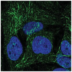 SPRY2 Antibody, Novus Biologicals 25 &mu;L; Unlabeled:Antibodies, Polyclonal