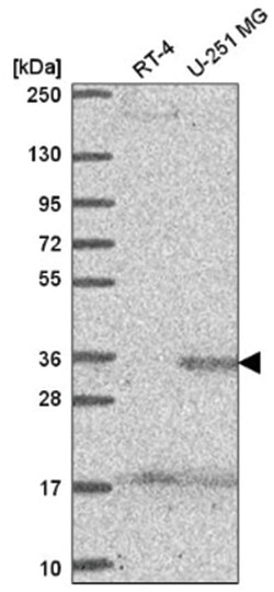 SPRY4 Antibody, Novus Biologicals:Antibodies:Primary Antibodies