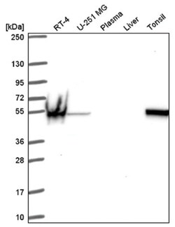 SPTLC1 Antibody, Novus Biologicals 25 &mu;L, Unlabeled:Antibodies, Polyclonal