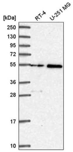 SPTLC3 Antibody, Novus Biologicals 25 &mu;L:Antibodies, Polyclonal