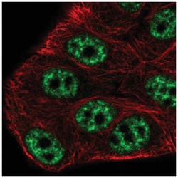SPTSSB Antibody, Novus Biologicals 25 &mu;L:Antibodies, Polyclonal