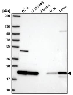 SRI Antibody, Novus Biologicals 25 &mu;L, Unlabeled:Antibodies, Polyclonal