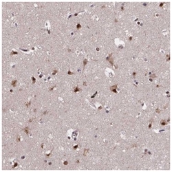 SR140 Antibody, Novus Biologicals 100&mu;L; Unlabeled:Antibodies, Polyclonal