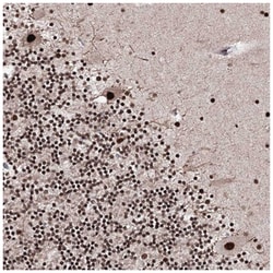 SR140 Antibody, Novus Biologicals 100&mu;L; Unlabeled:Antibodies, Polyclonal