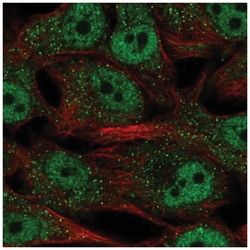 SREBP2 Antibody, Novus Biologicals 25 &mu;L, Unlabeled:Antibodies, Polyclonal