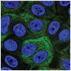 SRMS Antibody, Novus Biologicals 100&mu;L; Unlabeled:Antibodies, Polyclonal