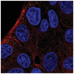 ST3GAL5 Antibody, Novus Biologicals:Antibodies:Primary Antibodies