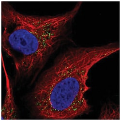 ST6 GalNAc alpha-2,6-sialyltransferaseV/ST6GALNAC5 Antibody, Novus Biologicals:Antibodies:Primary
