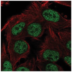 ST6GALNAC3 Antibody, Novus Biologicals:Antibodies:Primary Antibodies