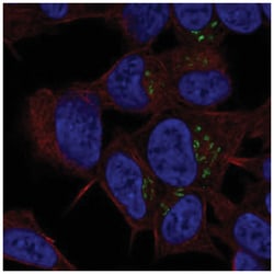 ST8SIA3 Antibody, Novus Biologicals:Antibodies:Primary Antibodies