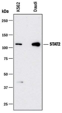 Human STAT2 Antibody, R D Systems 100&mu;g; Unlabeled:Antibodies, Monoclonal