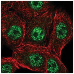 STK19 Antibody, Novus Biologicals 100&mu;L; Unlabeled:Antibodies, Polyclonal