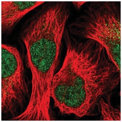STK33 Antibody, Novus Biologicals:Antibodies:Primary Antibodies
