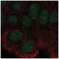 STK35 Antibody, Novus Biologicals 25 &mu;L:Antibodies, Polyclonal