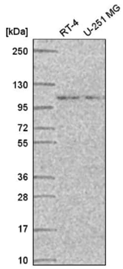 STRIP1 Antibody, Novus Biologicals 25 &mu;L, Unlabeled:Antibodies, Polyclonal