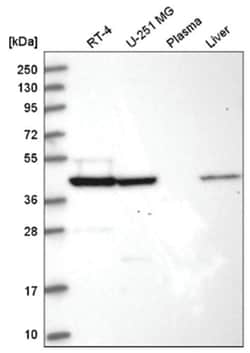 SUCLA2 Antibody, Novus Biologicals:Antibodies:Primary Antibodies