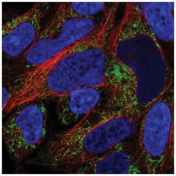 SUCLA2 Antibody, Novus Biologicals 25 &mu;L, Unlabeled:Antibodies, Polyclonal