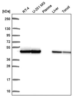 SUG1 Antibody, Novus Biologicals 25 &mu;L, Unlabeled:Antibodies, Polyclonal