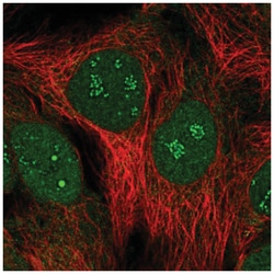 SUMO-interacting Motif (SIM) Antibody, Novus Biologicals 100&mu;L; Unlabeled:Antibodies,