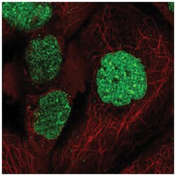 SUMO1 Antibody, Novus Biologicals:Antibodies:Primary Antibodies