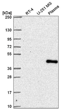 SUPT7L Antibody, Novus Biologicals 100&mu;L; Unlabeled:Antibodies, Polyclonal