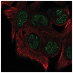 SUV420h1 Antibody, Novus Biologicals:Antibodies:Primary Antibodies