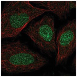 SYCE2 Antibody, Novus Biologicals:Antibodies:Primary Antibodies