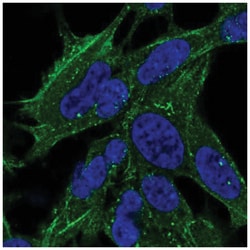 SYNPO2 Antibody, Novus Biologicals 25 &mu;L, Unlabeled:Antibodies, Polyclonal