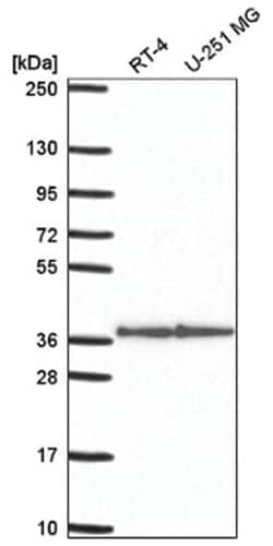 Syntaxin 12 Antibody, Novus Biologicals:Antibodies:Primary Antibodies