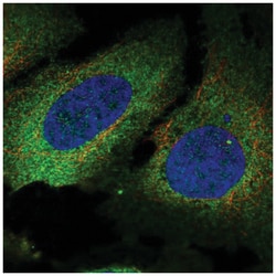 T Plastin Antibody, Novus Biologicals 100&mu;L; Unlabeled:Antibodies, Polyclonal