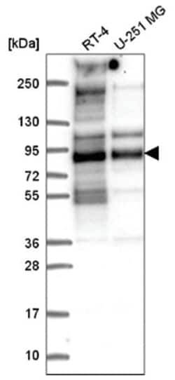 TACC2 Antibody, Novus Biologicals 25 &mu;L, Unlabeled:Antibodies, Polyclonal