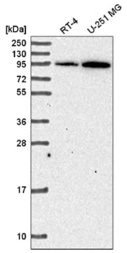 TACE/ADAM17 Antibody, Novus Biologicals:Antibodies:Primary Antibodies