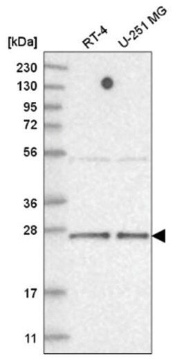 TAF11 Antibody, Novus Biologicals 100 &mu;L | Buy Online | Novus Biologicals | Fisher Scientific