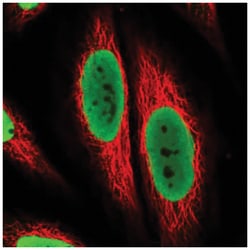 TAF15 Antibody, Novus Biologicals 100&mu;L; Unlabeled:Antibodies, Polyclonal