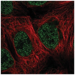 TAK1L Antibody, Novus Biologicals 25 &mu;L:Antibodies, Polyclonal