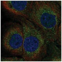 TAP1 Antibody, Novus Biologicals 25 &mu;L; Unconjugated:Antibodies, Polyclonal
