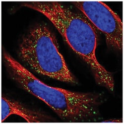 TAPT1 Antibody, Novus Biologicals 100&mu;L; Unlabeled:Antibodies, Polyclonal