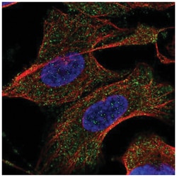 TARSL2 Antibody, Novus Biologicals 100&mu;L; Unlabeled:Antibodies, Polyclonal