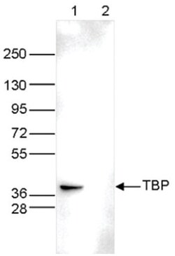TATA binding protein TBP Antibody (C.15200002), Novus Biologicals 100&mu;g;