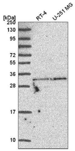TATDN1 Antibody, Novus Biologicals 100&mu;L; Unlabeled:Antibodies, Polyclonal