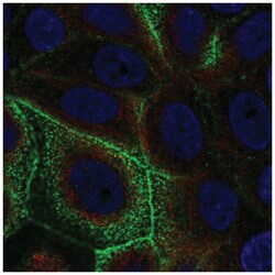 TBC1D10A Antibody, Novus Biologicals 25 &mu;L:Antibodies, Polyclonal