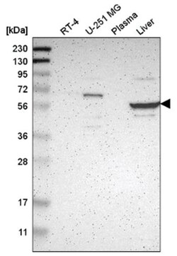 TBC1D10A Antibody, Novus Biologicals 100&mu;L; Unlabeled:Antibodies, Polyclonal