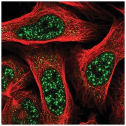TBC1D8 Antibody, Novus Biologicals 25 &mu;L, Unlabeled:Antibodies, Polyclonal