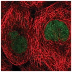 TBCK Antibody, Novus Biologicals 25 &mu;L | Buy Online | Novus Biologicals | Fisher Scientific