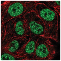TBK1 Antibody, Novus Biologicals 100&mu;L; Unlabeled:Antibodies, Polyclonal