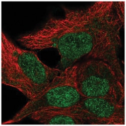 TBP like protein TLP Antibody, Novus Biologicals 100&mu;L; Unlabeled:Antibodies,