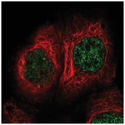 TBRG1 Antibody, Novus Biologicals 100&mu;L; Unlabeled:Antibodies, Polyclonal