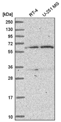 TBRG4 Antibody, Novus Biologicals 25 &mu;L, Unlabeled:Antibodies, Polyclonal