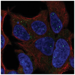 TBX1 Antibody, Novus Biologicals 100&mu;L; Unlabeled:Antibodies, Polyclonal
